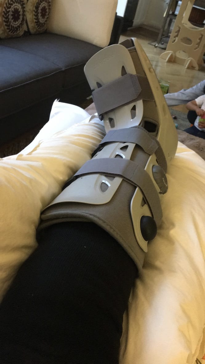 broken-leg